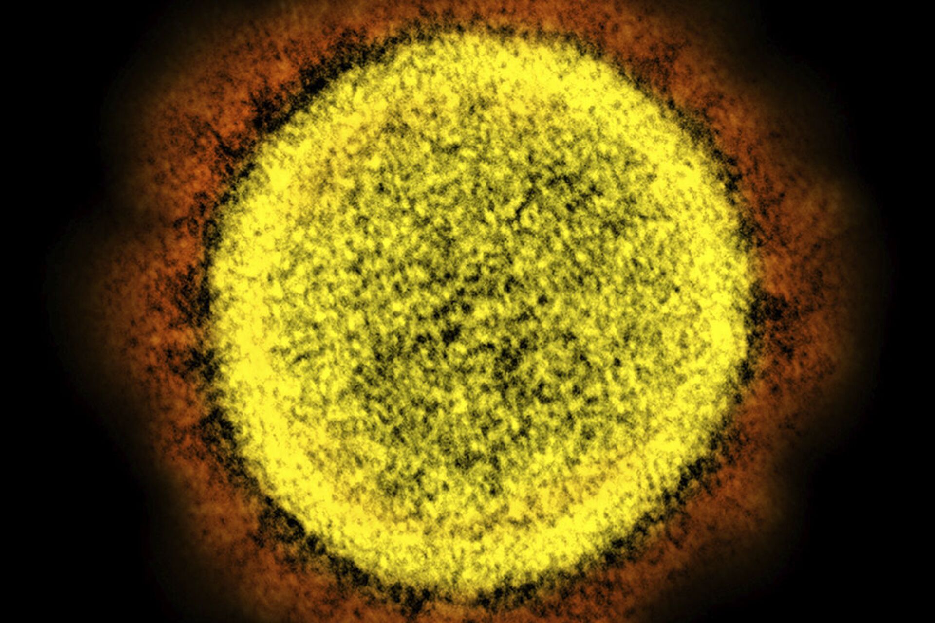 Descobertos na China 4 novos coronavírus aparentados com SARS-CoV-2 - Sputnik Brasil, 1920, 12.06.2021