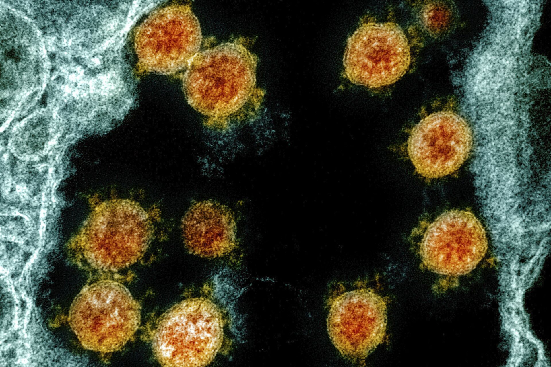 Qual é a cor da molécula do coronavírus? Cientistas revelam - Sputnik Brasil, 1920, 16.02.2021
