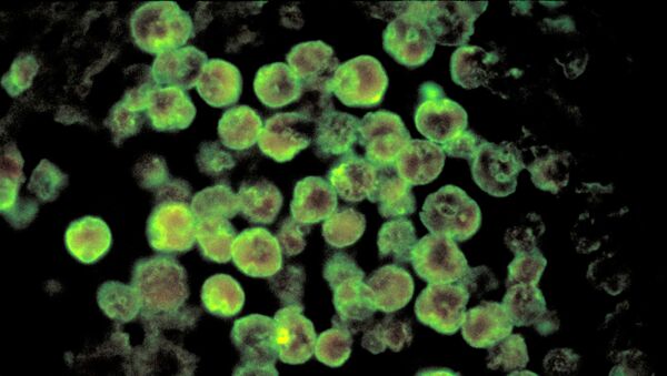 Ameba comedora de cérebros detectada no Texas, EUA - Sputnik Brasil