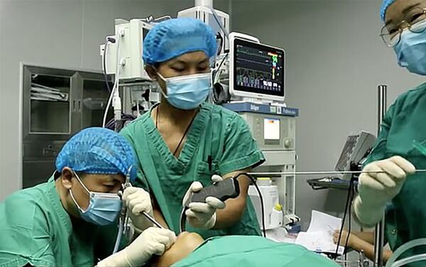 Cirurgiões durante a operação de extração de sanguessuga da cabeça do menino - Sputnik Brasil