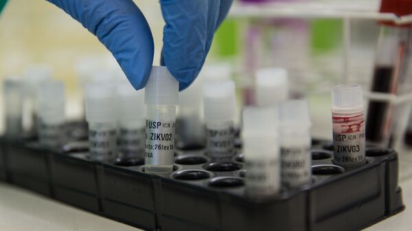 Pesquisador do Instituto de Ciências Biomédicas da Universidade de São Paulo (ICB-USP) manipula amostras de sangue contaminado pelo vírus da zika (foto de arquivo) - Sputnik Brasil