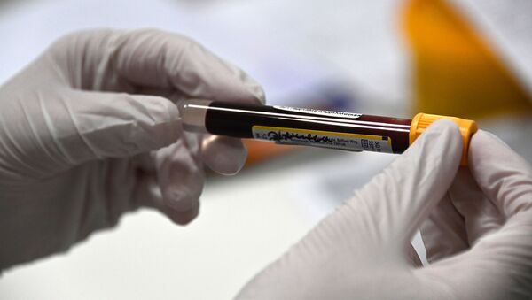 Оценка эффективности вакцины Sputnik V в лаборатории Гемотест - Sputnik Brasil