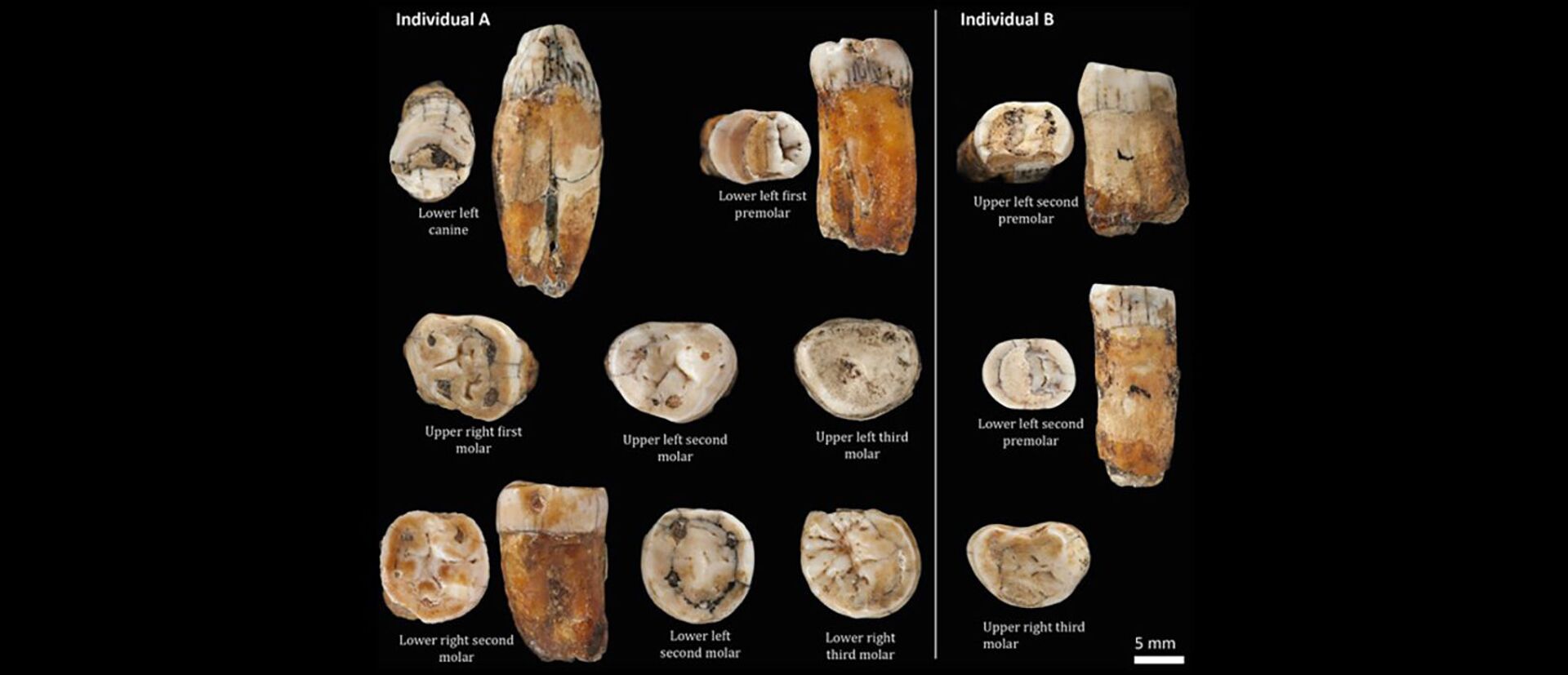 Dentes pré-históricos indicam sexo entre neandertais e Homo sapiens antes do que se pensava (FOTO) - Sputnik Brasil, 1920, 02.02.2021