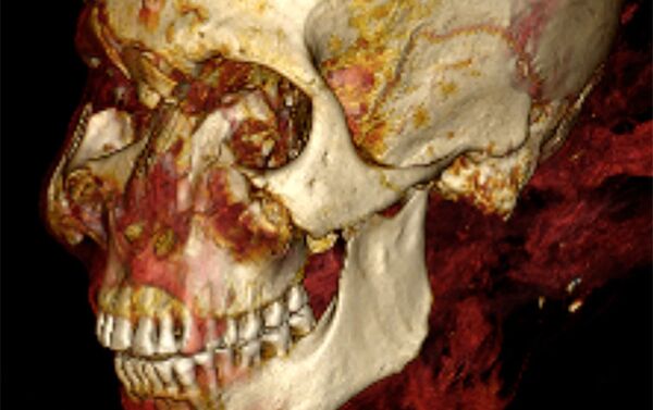 Tomografia computadorizada da cabeça da múmia do faraó Seqenenre Taa II  - Sputnik Brasil