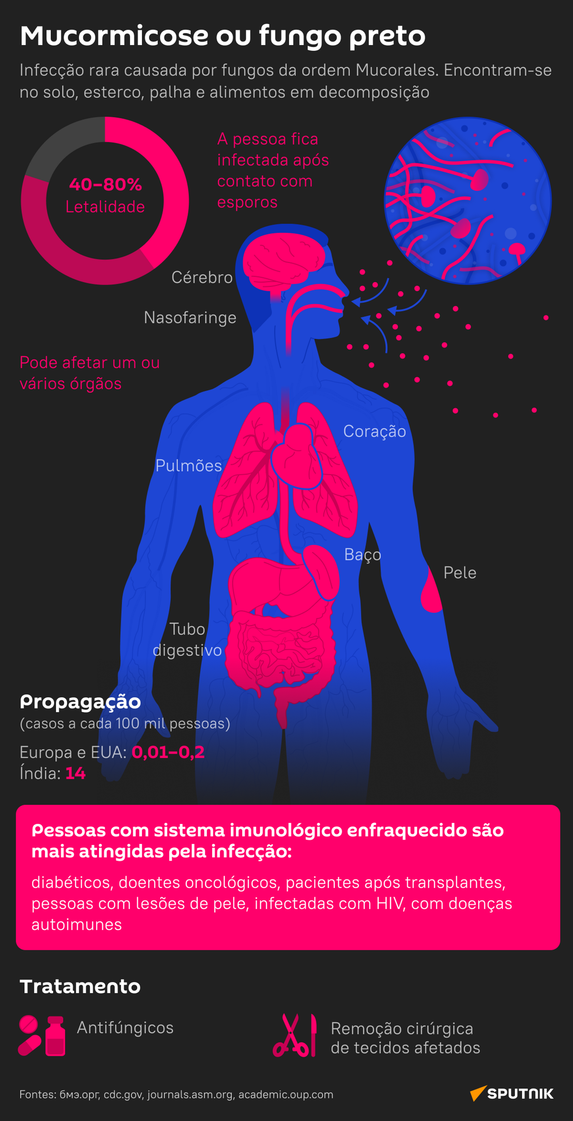 Mucormicose ou 'fungo preto': que doença é essa e quem corre mais risco - Sputnik Brasil, 1920, 18.06.2021