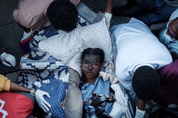 Moradora ferida por ataques aéreos chega em maca a hospital de Ayder em Mekele, capital da região de Tigré, Etiópia, 23 de junho de 2021 - Sputnik Brasil