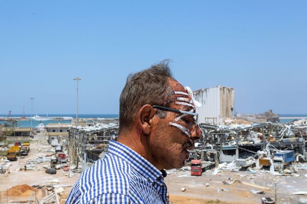 Foto Blast Scars (Cicatrizes da Explosão, na tradução) tirada pelo fotógrafo libanês Marc Abou Jaoude, terceiro lugar na categoria Humanidade. Foto mostra um motorista de caminhão ferido durante explosão do porto de Beirute em agosto de 2020 - Sputnik Brasil