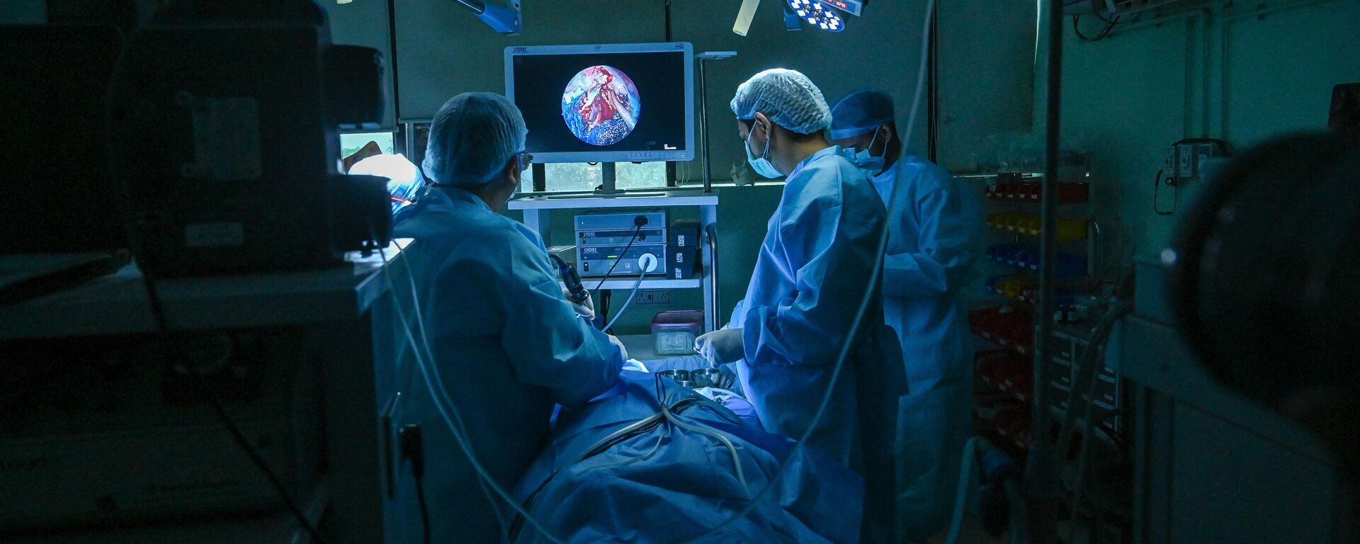O otorrinolaringologista Brajpal Singh Tyagi (E) realiza cirurgia para remover fungo preto em paciente que se recuperou da COVID-19 em um hospital em Ghaziabad. Foto de arquivo - Sputnik Brasil, 1920, 06.08.2021