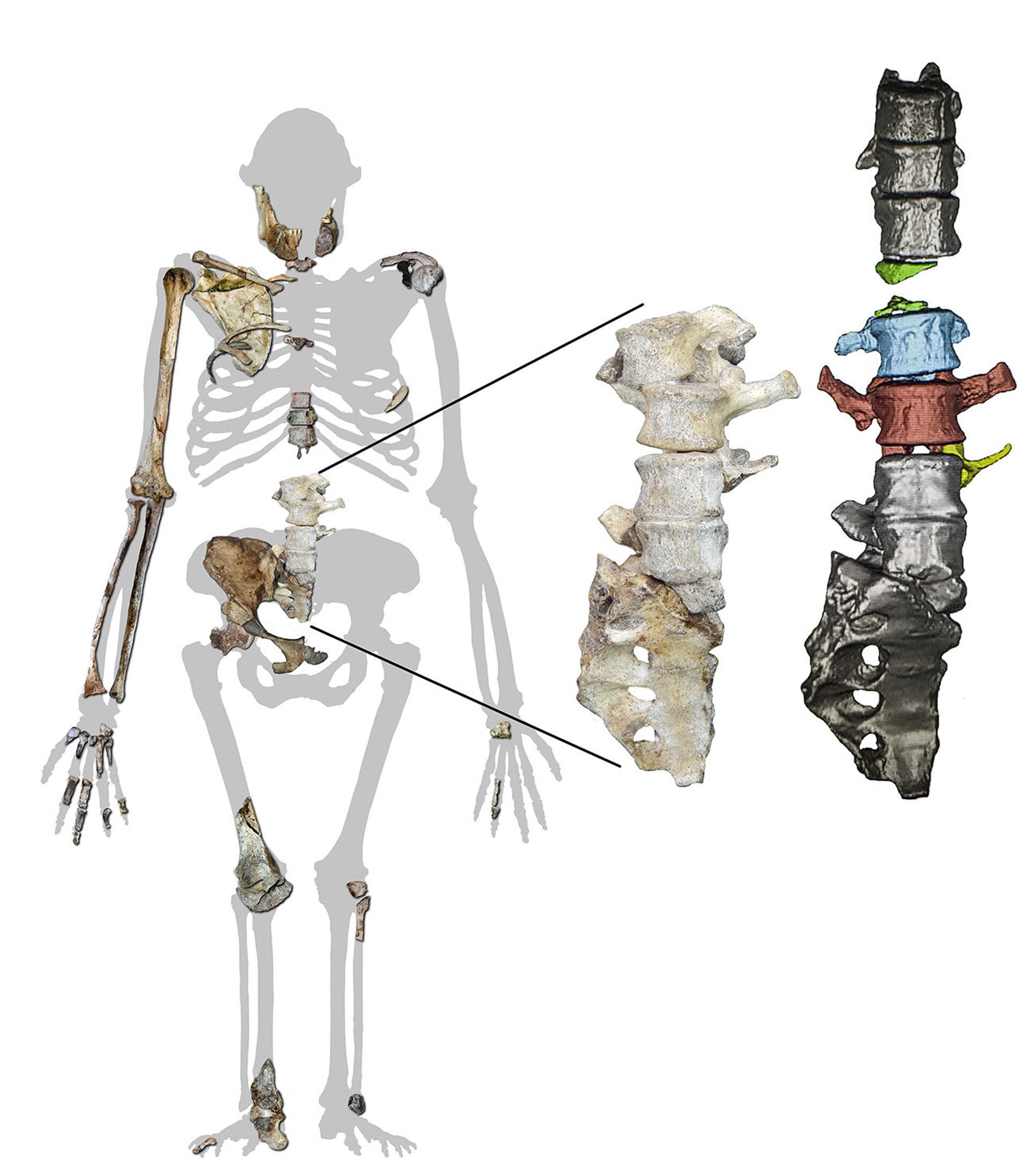Silhueta do Australopithecus sediba mostrando as vértebras recém-encontradas junto com outros restos de esqueletos da espécie. O detalhe ampliado (uma fotografia dos fósseis em articulação à esquerda; modelos de microtomografia computadorizada à direita) mostra os fósseis recém-descobertos, em cores à direita, entre elementos previamente conhecidos, em cinza - Sputnik Brasil, 1920, 25.11.2021