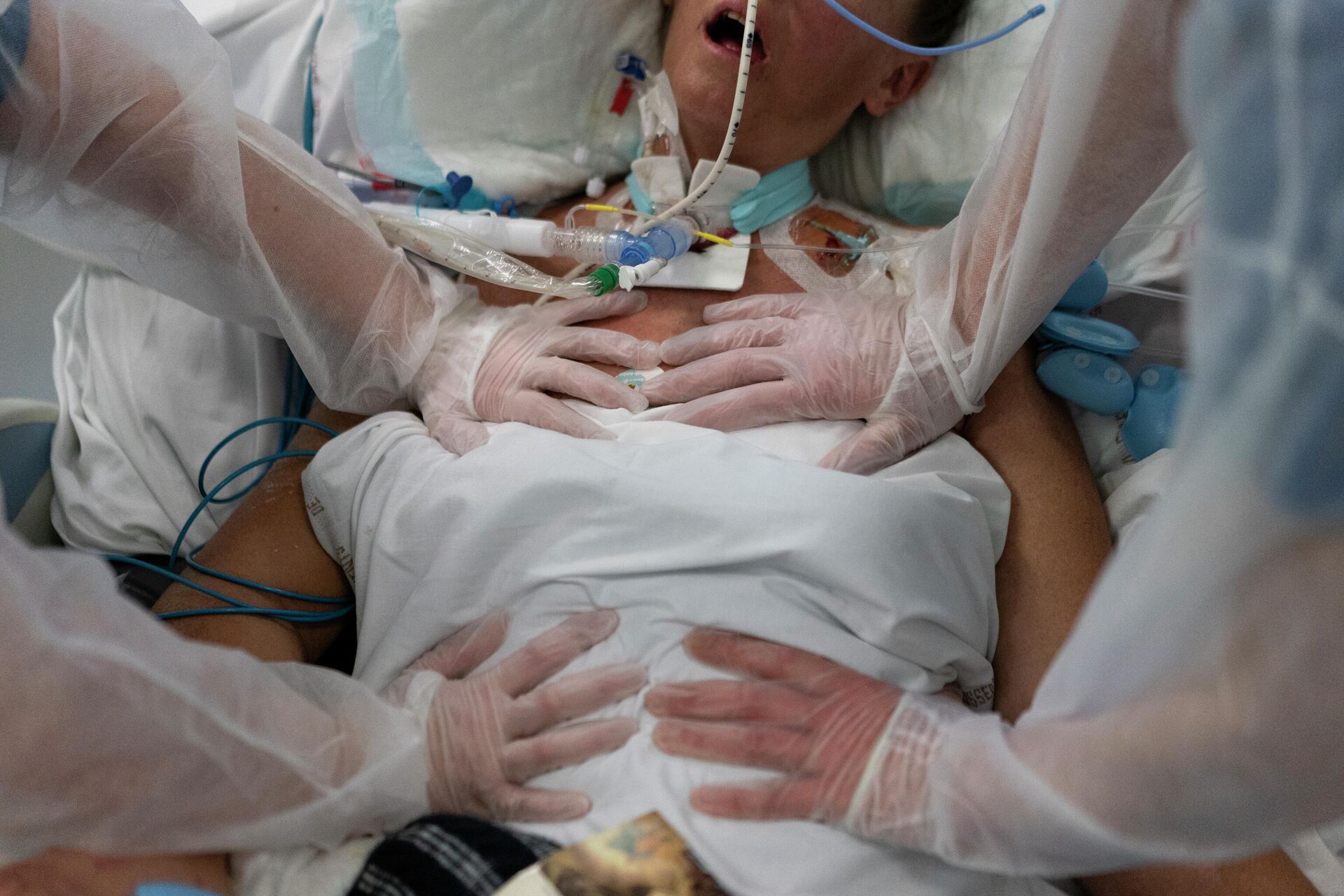 Enfermeiras realizam exercícios respiratórios em uma paciente da COVID-19 no Centro Hospitalar de La Timone em Marselha, sul da França, 31 de dezembro de 2021 - Sputnik Brasil, 1920, 04.01.2022