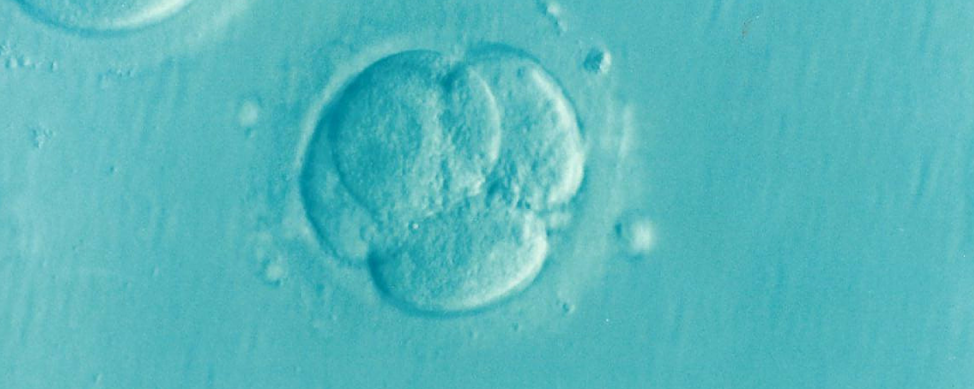 Microfertilização embrionária (Imagem de referência) - Sputnik Brasil, 1920, 08.02.2022