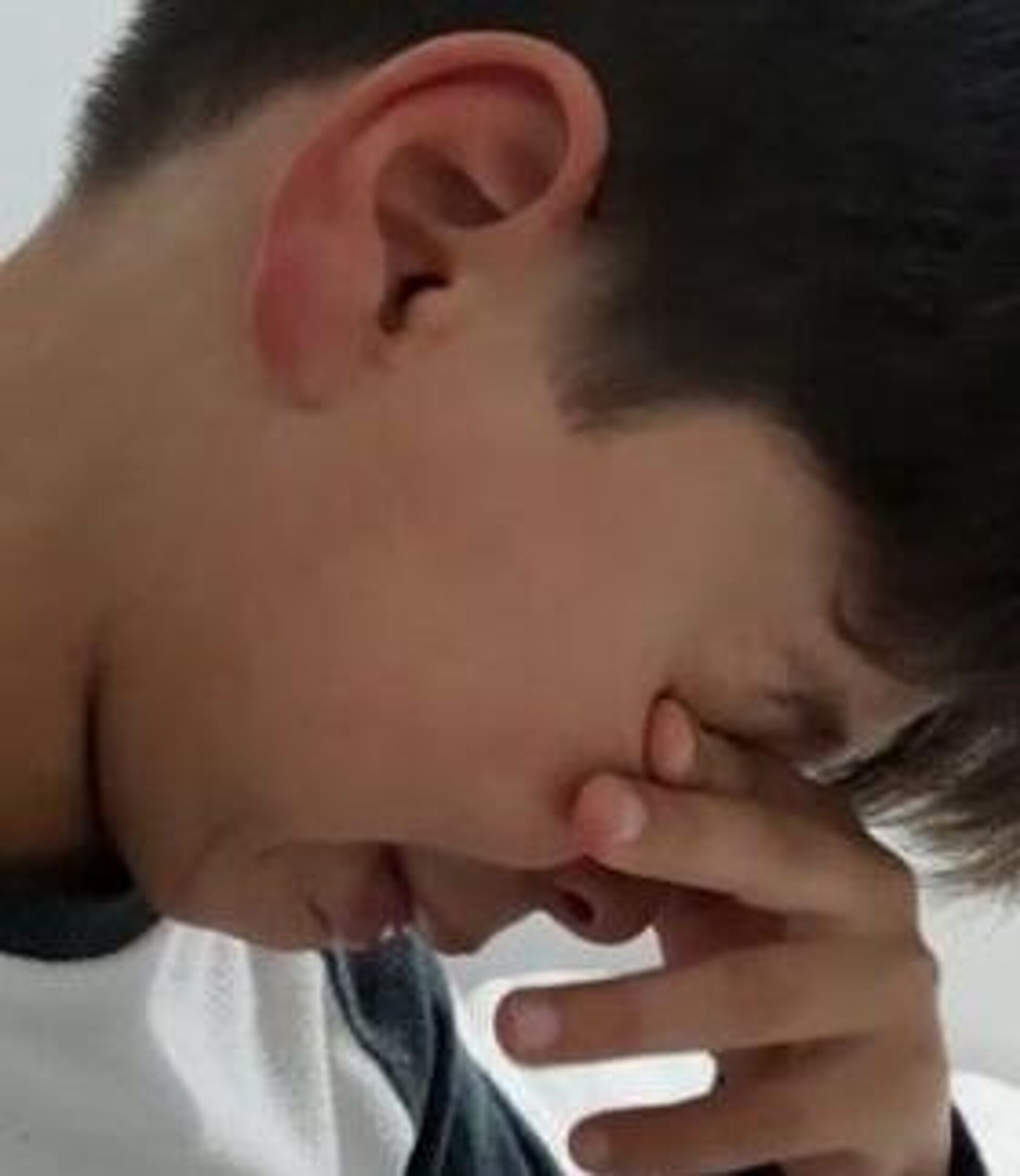 Escoriações na orelha do brasileiro X., de 8 anos, após ter sido agredido na escola - Sputnik Brasil, 1920, 14.02.2022