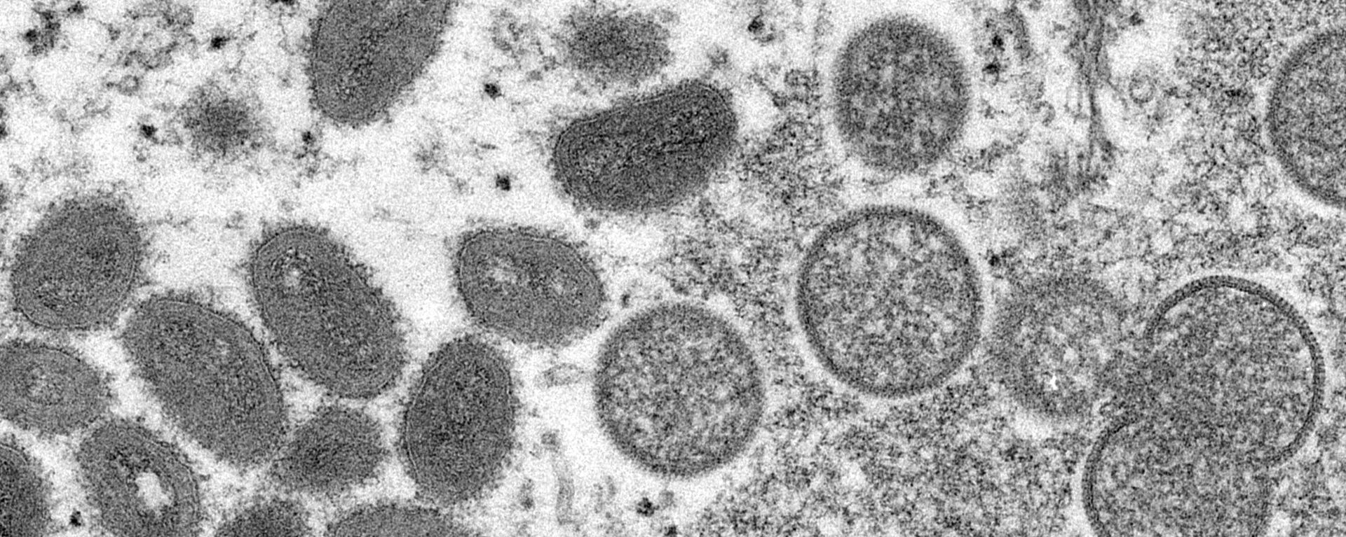 Vírions de varíola dos macacos, maduros e ovais (à esquerda), e vírions imaturos, esféricos (à direita), obtidos de amostra de pele humana associada ao surto de cães da pradaria de 2003 - Sputnik Brasil, 1920, 29.07.2022