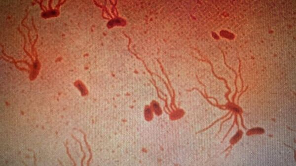 Bactéria Salmonella enterica (cropped photo) - Sputnik Brasil