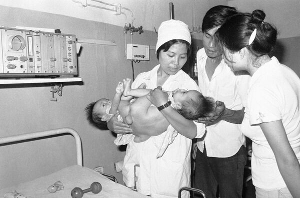 Dois gêmeos siameses de um ano de idade no Hospital Viet Duc, em Hanói. Este centro era especializado no tratamento de crianças afetadas pelo agente laranja, utilizado pelo Exército norte-americano durante a guerra. - Sputnik Brasil