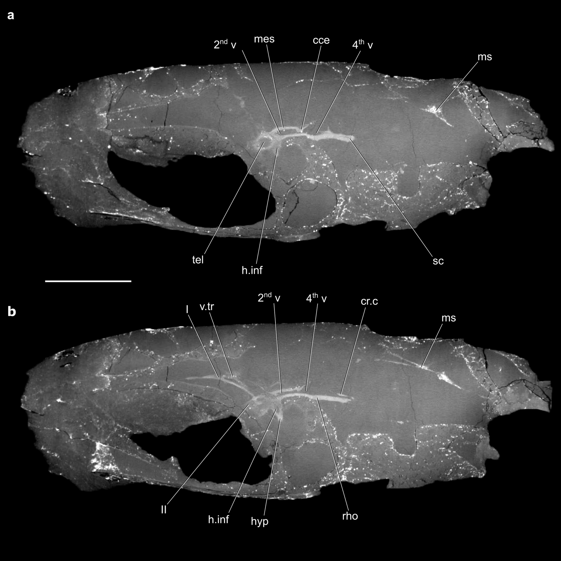 Uma tomografia computadorizada do crânio de um peixe de 319 milhões de anos revelou o cérebro mais antigo e preservado de um animal com espinha dorsal - Sputnik Brasil, 1920, 02.02.2023