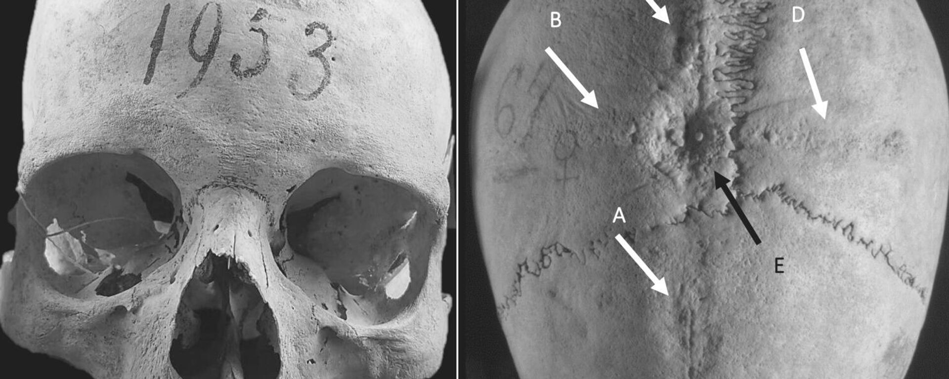 Processo de moldagem e fundição no crânio CT1953.  - Sputnik Brasil, 1920, 14.02.2023