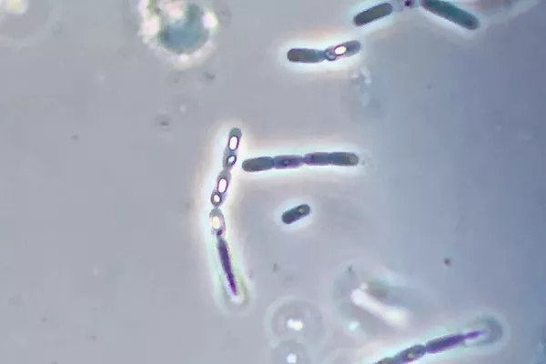 Bacillus thuringiensis usado como bioinseticida na agricultura - Sputnik Brasil