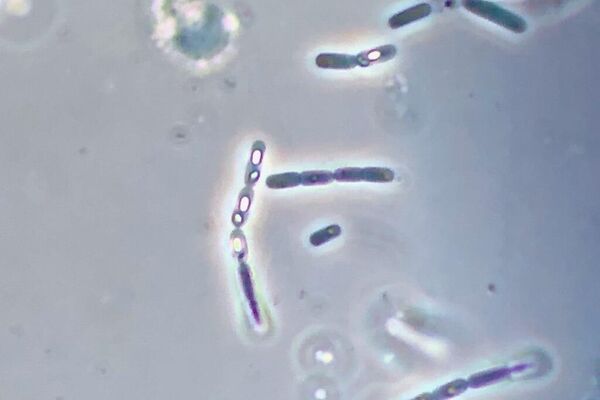 Foto do Bacillus thuringiensis, onde se observa dentro da célula o esporo oval e mais claro e o cristal, menor e mais escuro - Sputnik Brasil