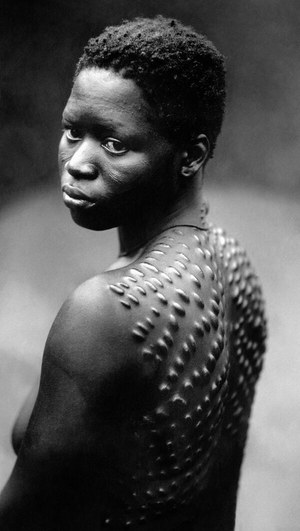 Jovem africana com cicatrizes no corpo - Sputnik Brasil