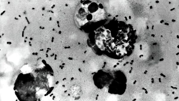 Bactérias da praga bubônica retiradas de um paciente (imagem de arquivo) - Sputnik Brasil