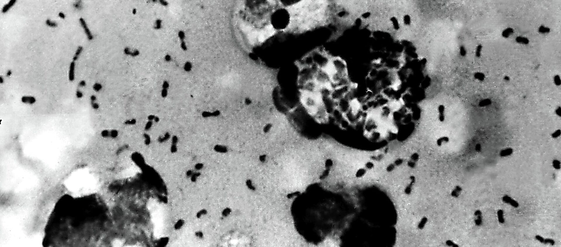 Bactérias da praga bubônica retiradas de um paciente (imagem de arquivo) - Sputnik Brasil, 1920, 07.07.2020