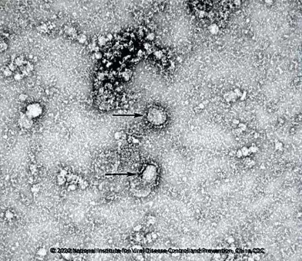 Primeira foto do novo coronavírus feita com microscópio eletrônico por cientistas chineses - Sputnik Brasil