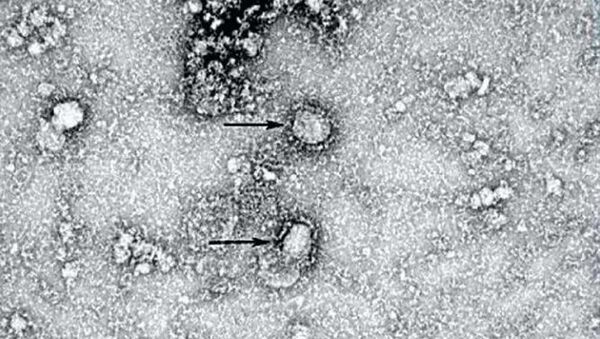 Primeira foto do novo coronavírus feita com microscópio eletrônico por cientistas chineses - Sputnik Brasil