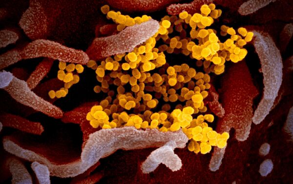 Imagem de microscópio eletrônico de varredura mostra SARS-CoV-2 na cor amarela - Sputnik Brasil