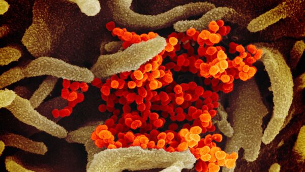 Imagem de microscópio eletrônico de varredura mostra SARS-CoV-2 na cor laranja avermelhando - Sputnik Brasil