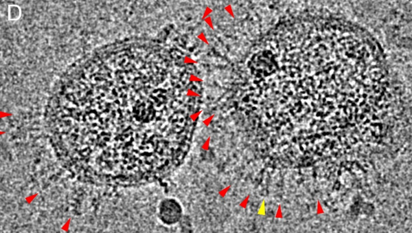 Vírus SARS-CoV-2 sob microscópio eletrônico Cryo-EM, que analisa amostras a temperaturas criogênicas - Sputnik Brasil