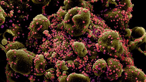 Micrografia eletrônica digitalmente colorida de uma célula apoptótica (castanha esverdeada) fortemente infectada com partículas do vírus SARS-CoV-2 (rosa) - Sputnik Brasil