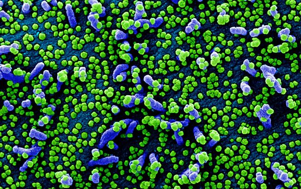 Micrografia eletrônica digitalmente colorida de uma célula VERO E6 (azul) fortemente infectada com partículas do vírus SARS-CoV-2 (verde) - Sputnik Brasil