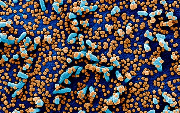 Micrografia eletrônica digitalmente colorida de uma célula VERO E6 (azul) bastante infectada com partículas do vírus SARS-COV-2 (laranja) - Sputnik Brasil