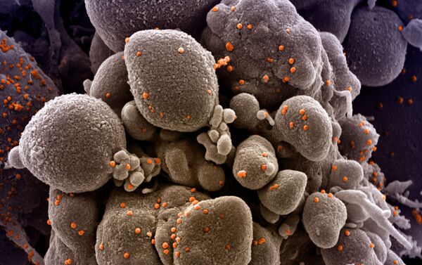Micrografia eletrônica digitalmente colorida de uma célula apoptótica (tan) infectada com partículas do vírus SARS-CoV-2 (laranja) - Sputnik Brasil