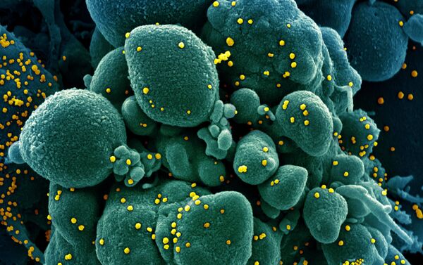 Micrografia eletrônica digitalmente colorida de uma célula apoptótica (verde) infectada com partículas do vírus SARS-CoV-2 (amarelo) - Sputnik Brasil