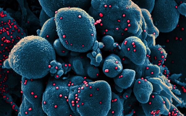 Micrografia eletrônica digitalmente colorida de uma célula apoptótica (azul) infectada com partículas do vírus SARS-CoV-2 (vermelho) - Sputnik Brasil