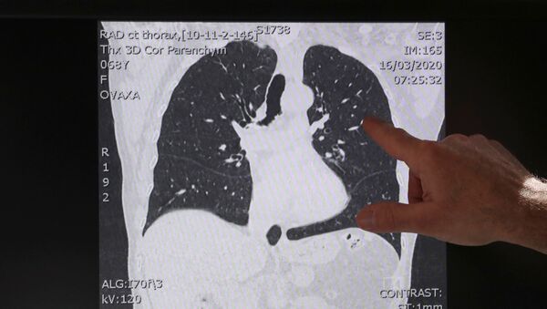 Médico belga Demeyer exibe imagem escaneada de pulmões de pessoa saudável em Aalst - Sputnik Brasil