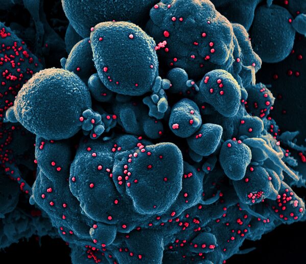 Imagem colorida de célula infectada pelo coronavírus - Sputnik Brasil