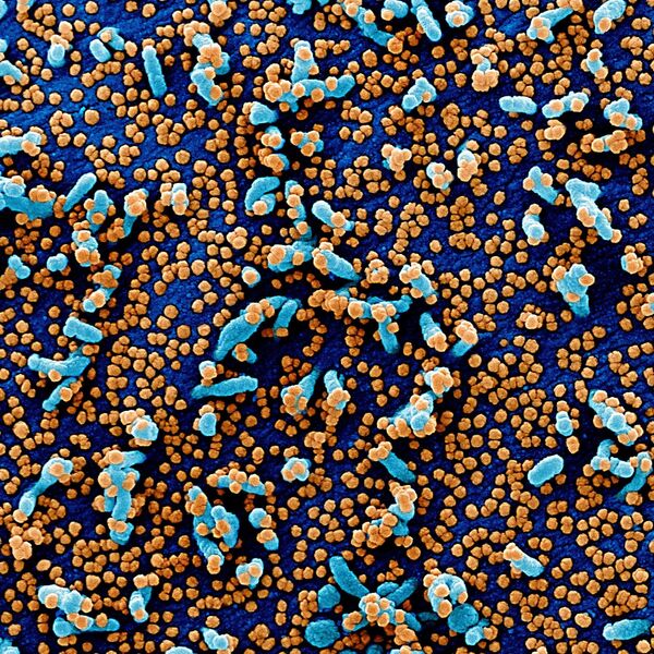 Microscópio revela imagem colorida de células afetadas pelo coronavírus - Sputnik Brasil