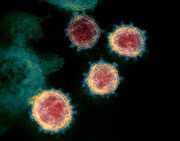 Partículas do coronavírus emergem da superfície de células cultivadas em laboratório - Sputnik Brasil