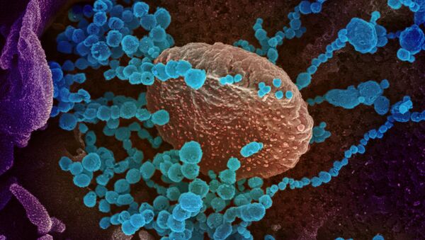 Visão de uma célula infectada pelo coronavírus sob um microscópio - Sputnik Brasil