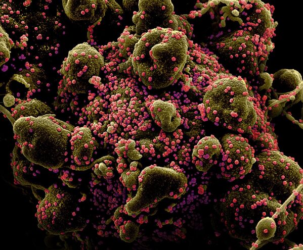 Imagem colorida de célula infectada pelo coronavírus - Sputnik Brasil