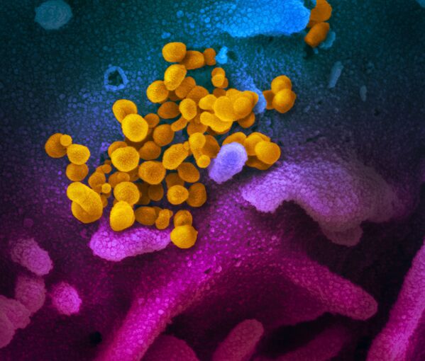 Imagem registrada por um microscópio do vírus responsável pela COVID-19 - Sputnik Brasil