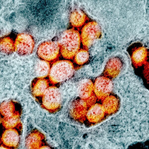 Microfotografia de célula infectada pelo coronavírus - Sputnik Brasil