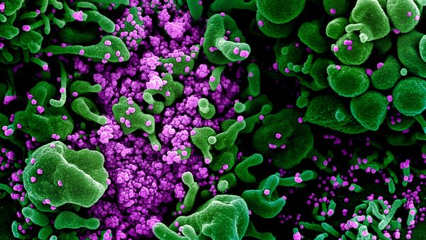 Microfotografia de partículas de coronavírus na célula de uma pessoa infectada - Sputnik Brasil