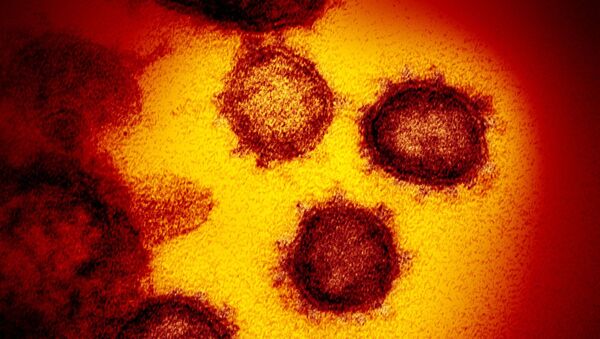 Imagem de microscópio eletrônico do SARS-CoV-2, o vírus que causa a COVID-19 - Sputnik Brasil