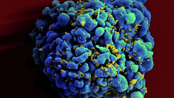 célula infetada com HIV - Sputnik Brasil