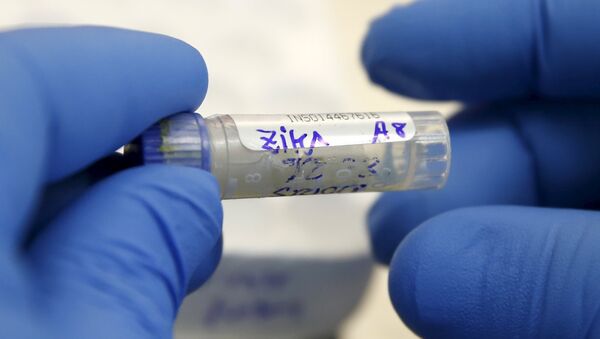 Agente de saúde analisa amostra de sangue de paciente com suspeitas de zika no Instituto Nacional de Saúde de Lima, Peru, em 2 de fevereiro de 2016 - Sputnik Brasil