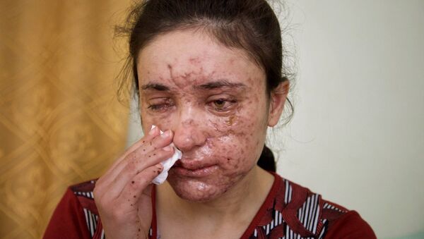 Menina yazidi de 18 anos de idade, Jesidin Lamiya Adschi Baschar, que  foi espancada e estuprada muitas vezes no seu cativeiro do Daesh - Sputnik Brasil